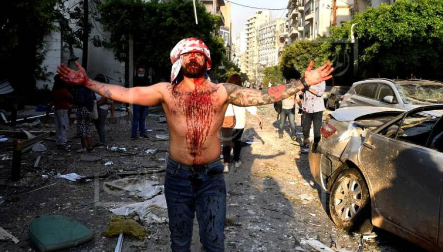18+Մարդկանց արյունոտ ու սարսափելի լուսանկարներ` պայթյունից հետո